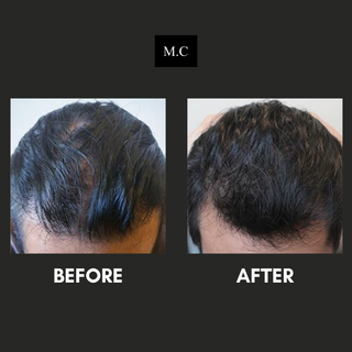 Jacob’s Natural Hair Growth Kit